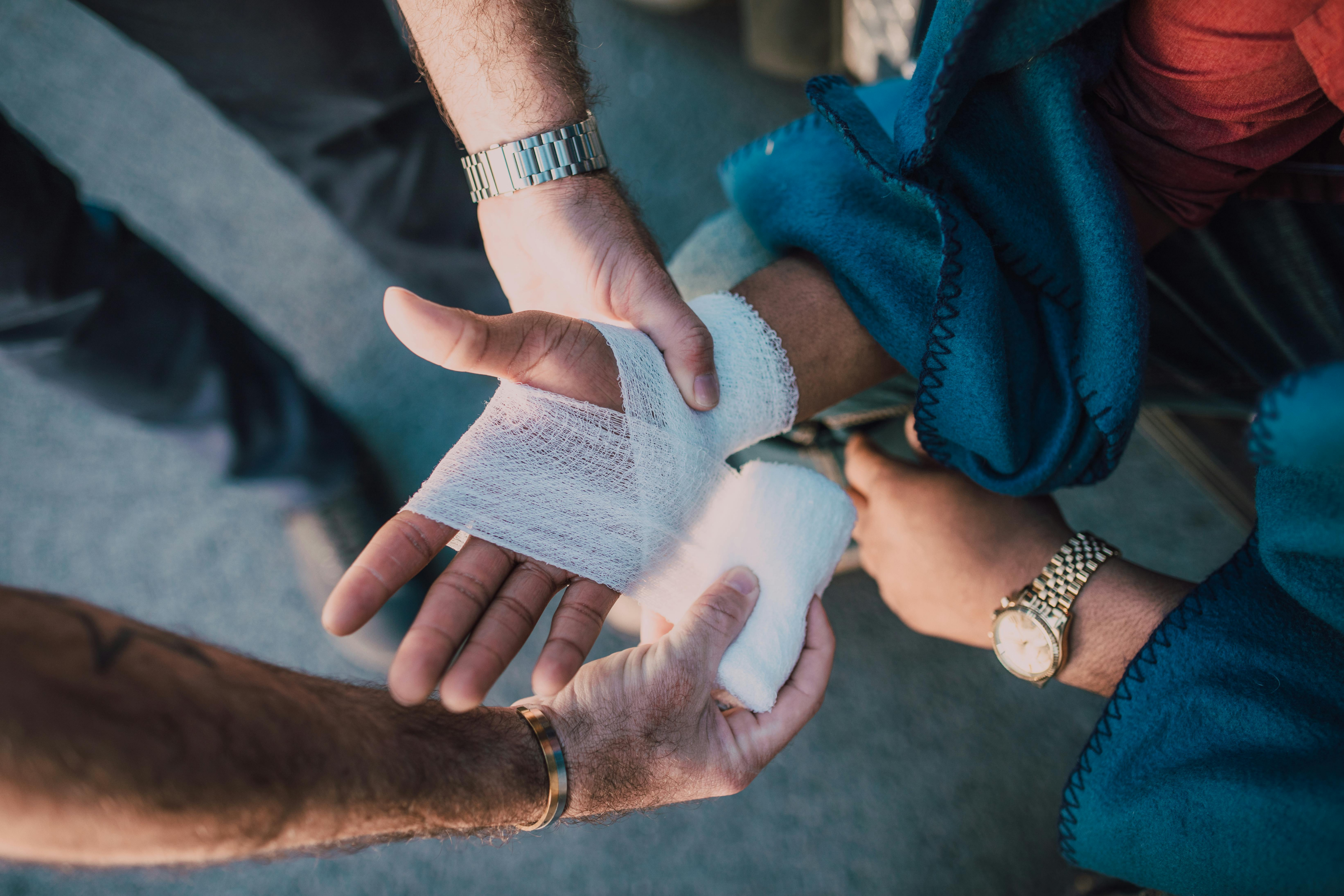 Find your Wesley Chapel burn injury lawyer at Hancock Injury Attorneys